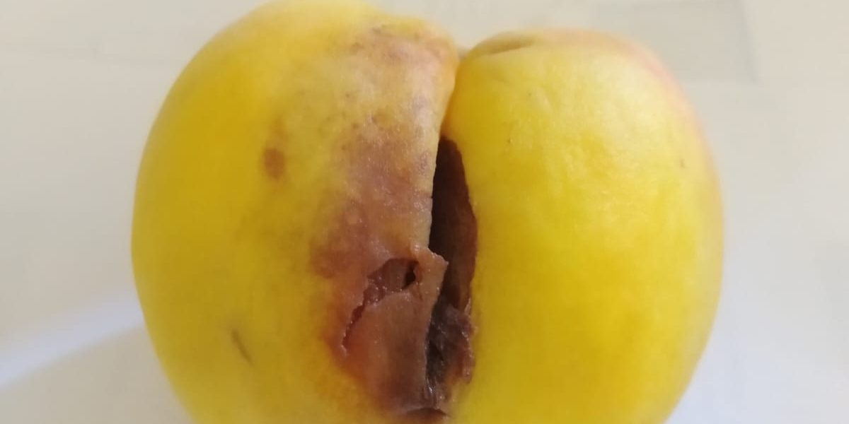 salud anal salud sexual